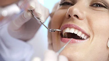 Ilustración de un tratamiento de endodoncia